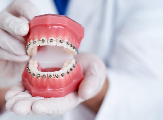 Dentist with white gloves holding model of teeth with braces