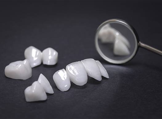 four metal-free restorations