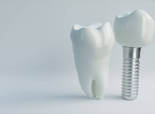 dental implant with crown next to a natural tooth