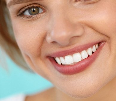 young woman smiling after a smile makeover 
