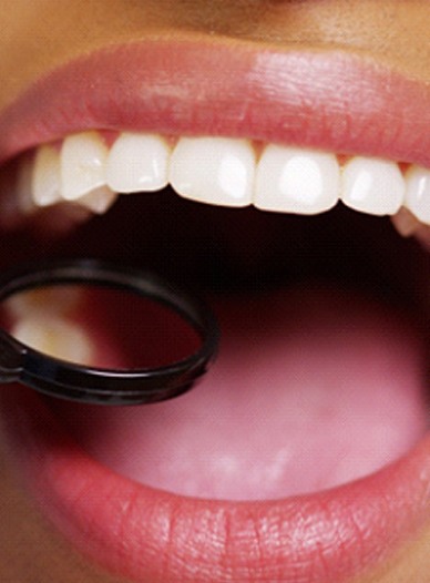 Closeup of patient with tooth-colored fillings in Moses Lake