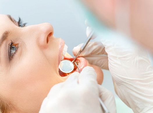 Woman getting a tooth-colored filling in Moses Lake