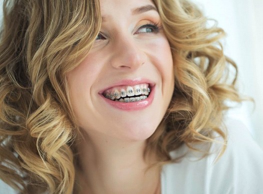 a woman smiling while undergoing the traditional braces process