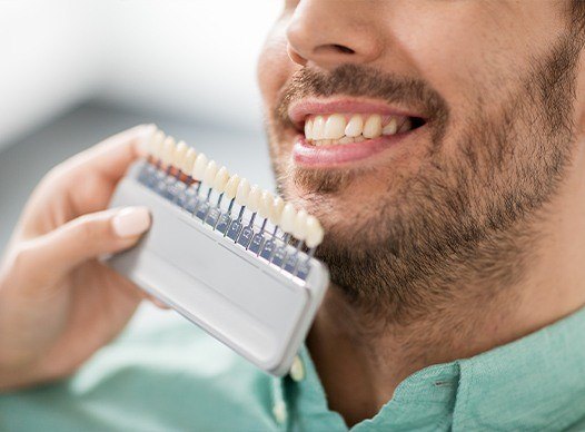 man smiling with shade chart in front of smile