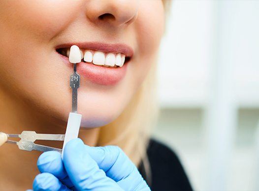 woman having smile checked for correct tooth color