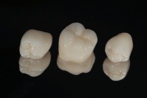 three dental crowns in Moses Lake against black background 