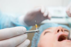 Blurry background of someone in the dentist's chair while the dentist holds an implant rod with forceps in the foreground